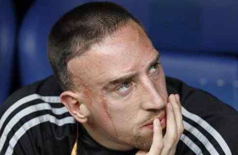 Frank Ribery scar